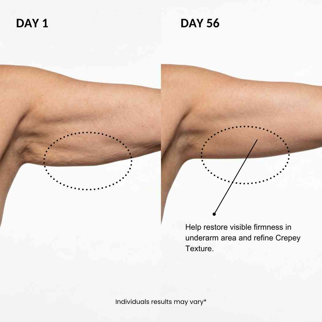 ESTRAFIRM™ For the Arms Menopause Changed