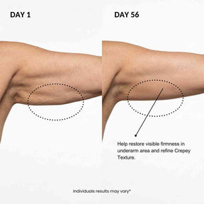 ESTRAFIRM™ For the Arms Menopause Changed