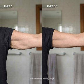 ESTRAFIRM™ For the Arms Menopause Changed